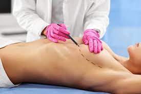 Рак молочної залози